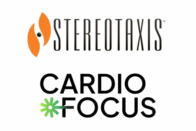 Stereotaxis and CardioFocus collaborate to advance robotic PFA for cardiac arrhythmias