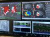 Corify announces studies validating 4D cardiac mapping system following US FDA clearance