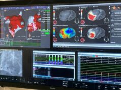 Corify announces studies validating 4D cardiac mapping system following US FDA clearance