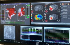 Corify announces studies validating 4D cardiac mapping system following US FDA clearance