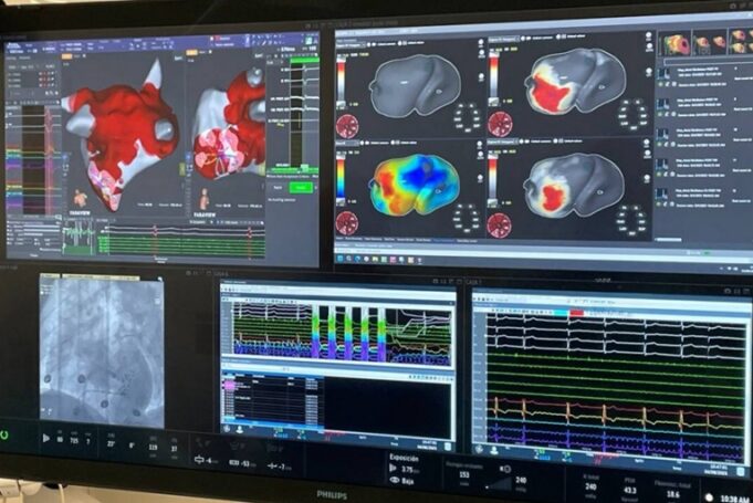 Corify announces studies validating 4D cardiac mapping system following US FDA clearance