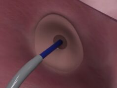 Protaryx Medical receives US FDA clearance for proprietary transseptal puncture device